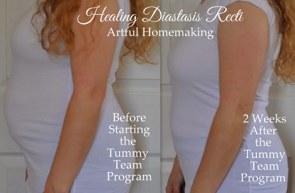 Week 2 With the Tummy Team {Healing Diastasis Recti}