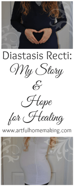 Heating Diastasis Recti